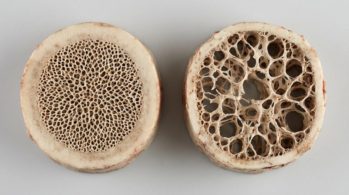Why Bones Need Collagen, Not Just Calcium: What the Research Shows