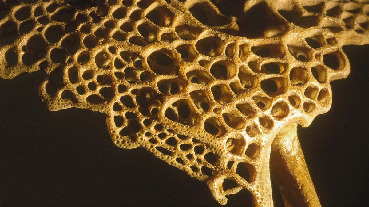 Osteopenia vs Osteoporosis: What the Difference Means for You