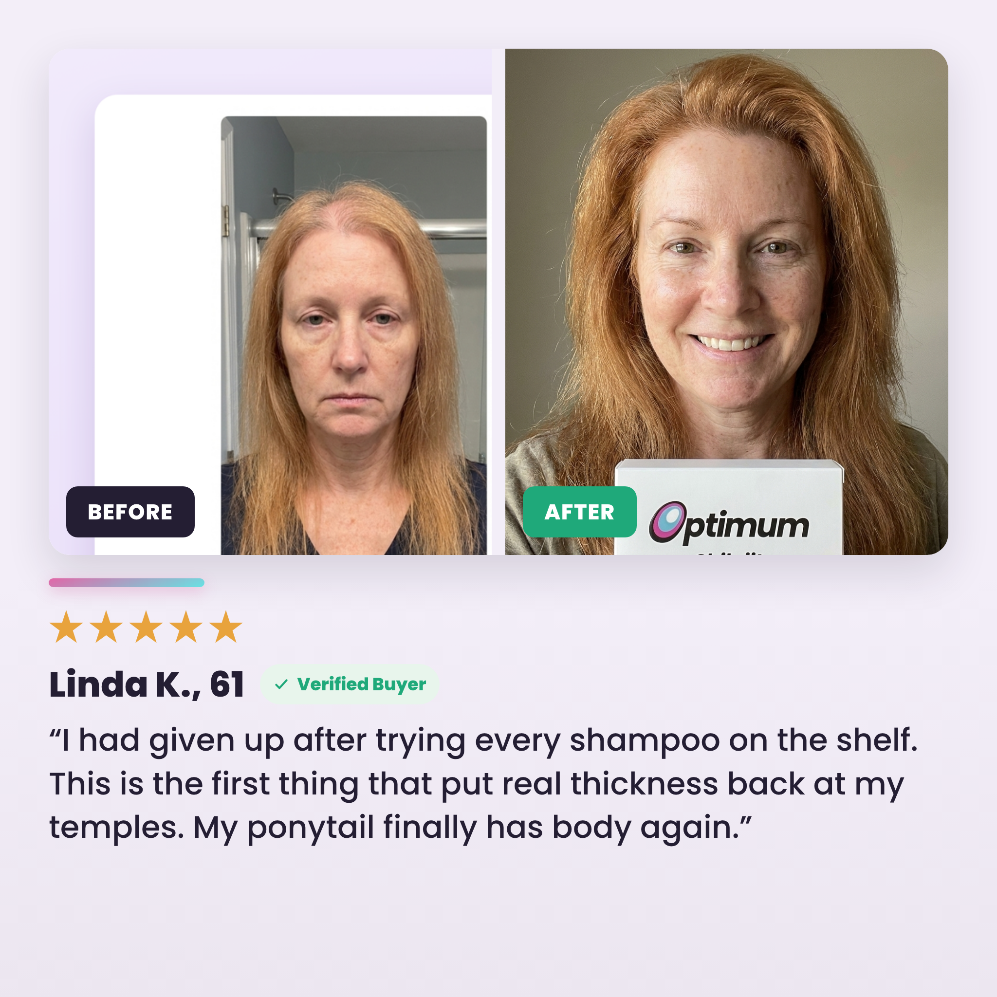Linda K., 61 — before and after, real thickness back at the temples