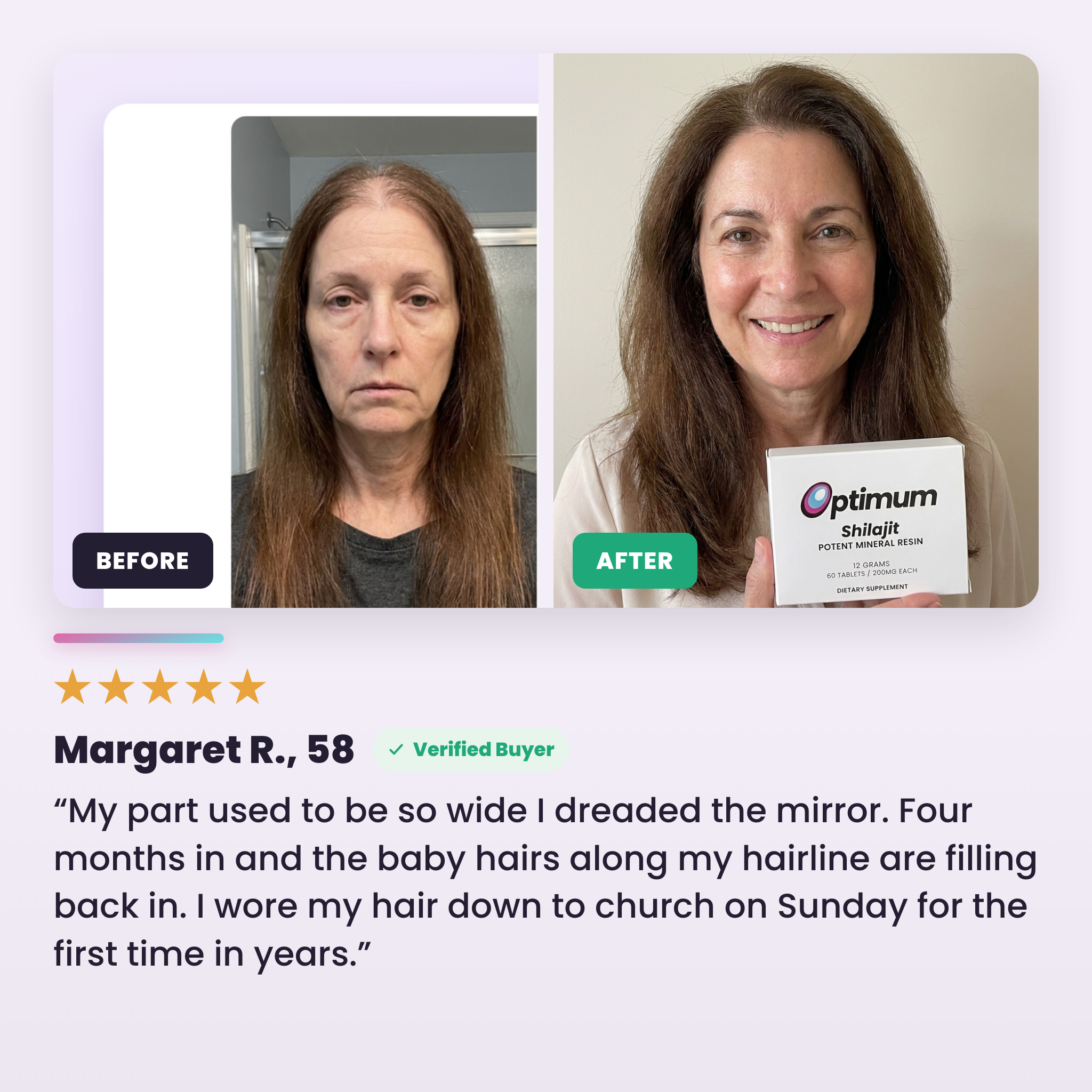 Margaret R., 58 — before and after, hair filling in along the part